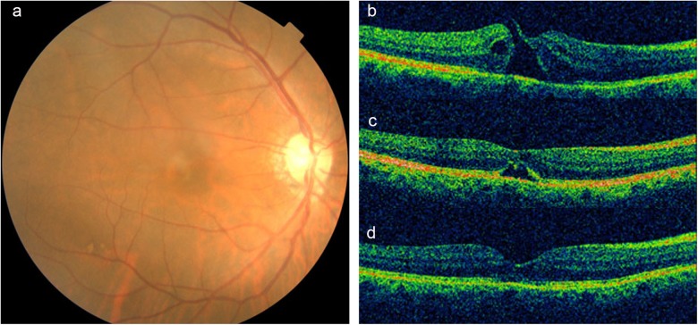 Fig. 1