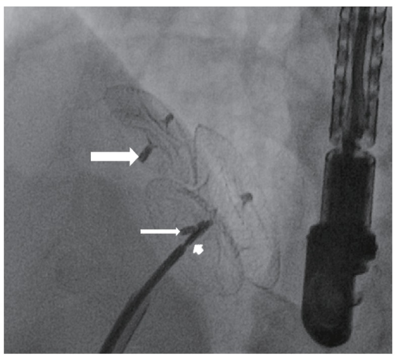 Fig. 1