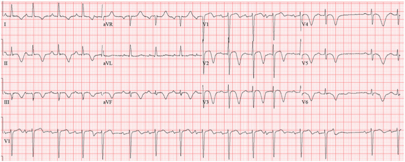 Figure 2.