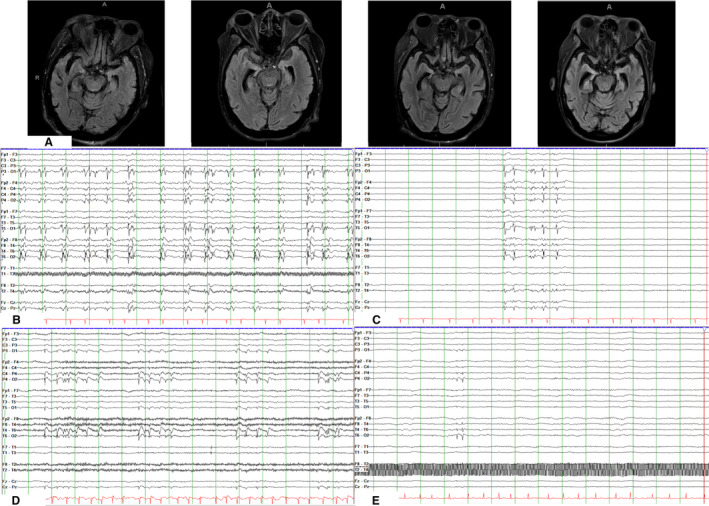 FIGURE 1