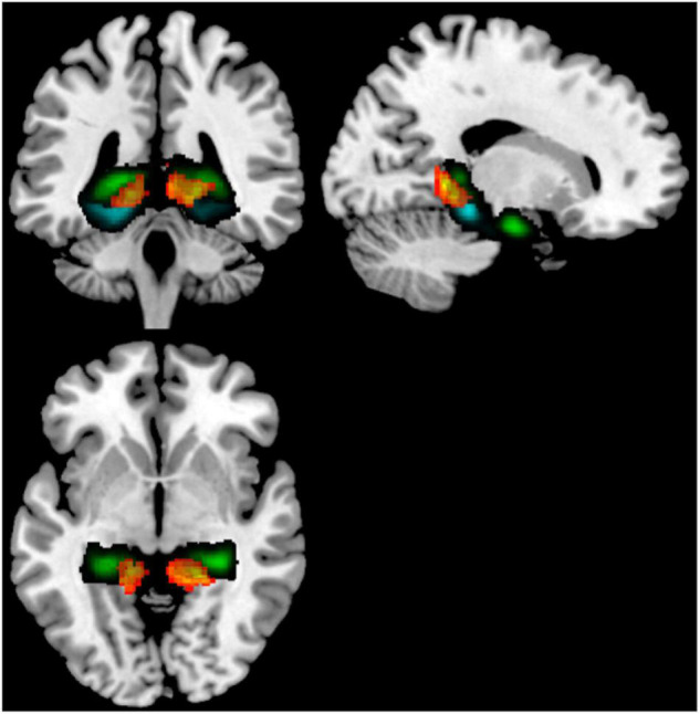 FIGURE 3