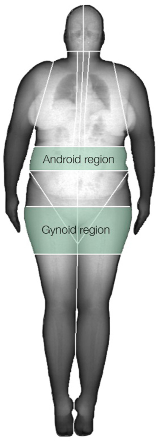 FIGURE 1