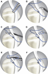 Fig 8