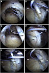 Fig 6
