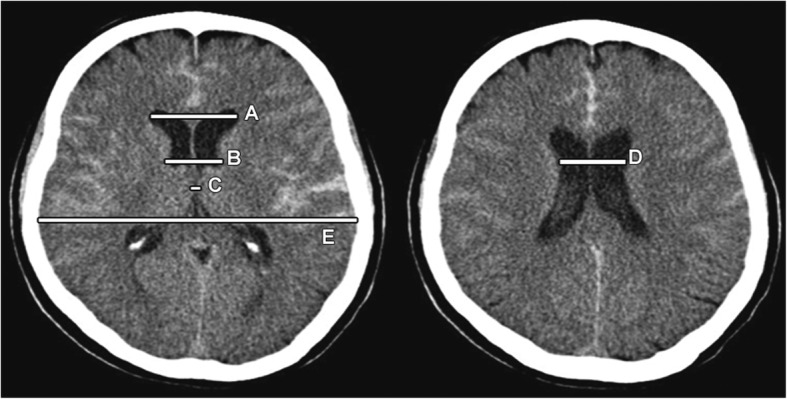 Fig. 1