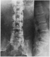 63