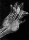 67