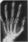 66