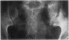 62