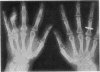66