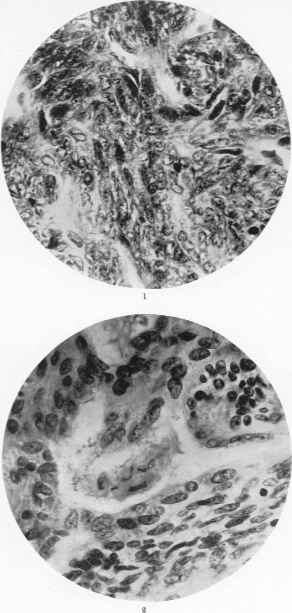 Figs 1 and 2