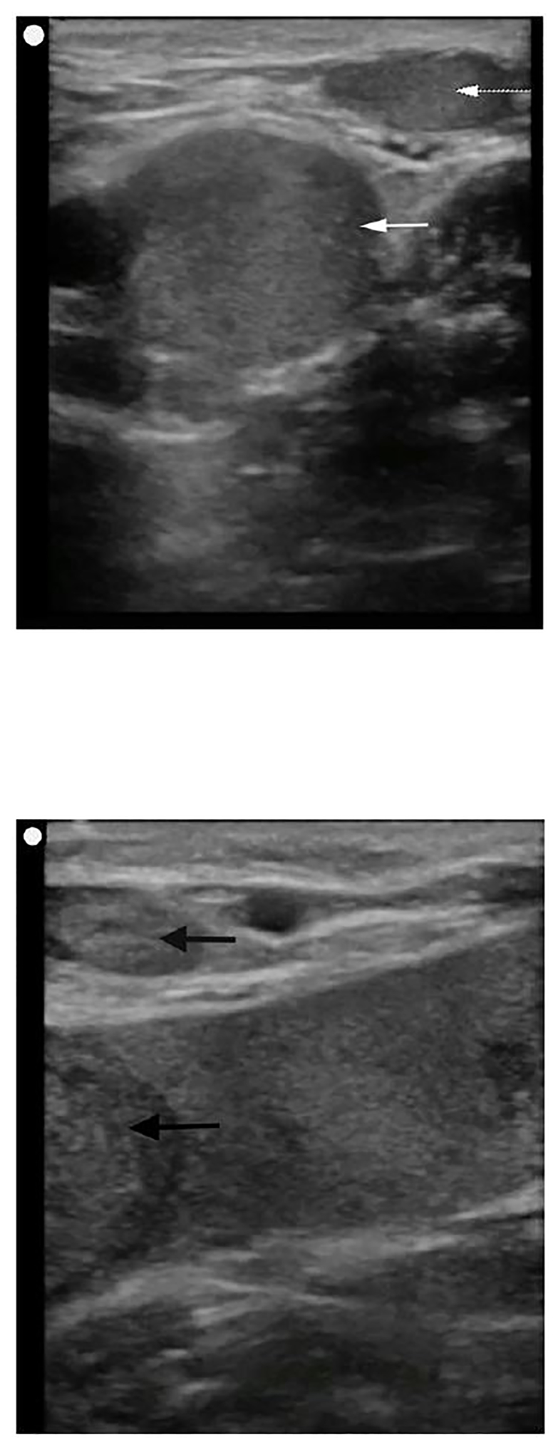 Image 2A and 2B