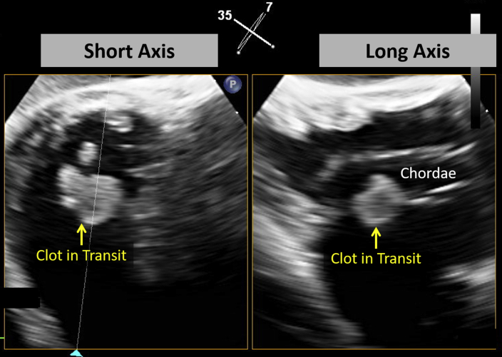 Figure 3