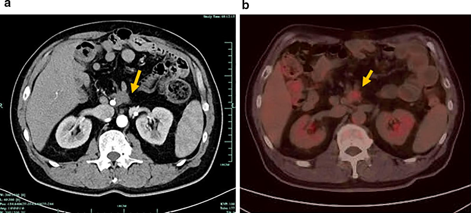 Fig. 3