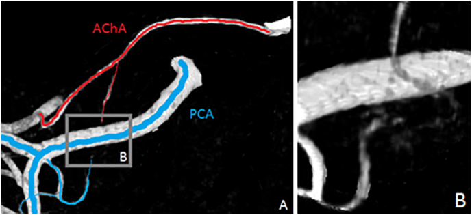 Fig. 6