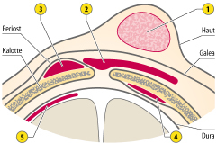 graphic file with name 978-3-662-57295-5_4_Fig12_HTML.jpg