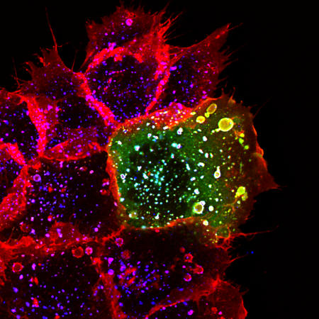 Rabankyrin-5 (green) colocalizes with rhodamine-conjugated EGF on macropinosomes after growth factor stimulation