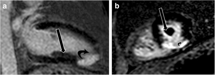 Fig. 17