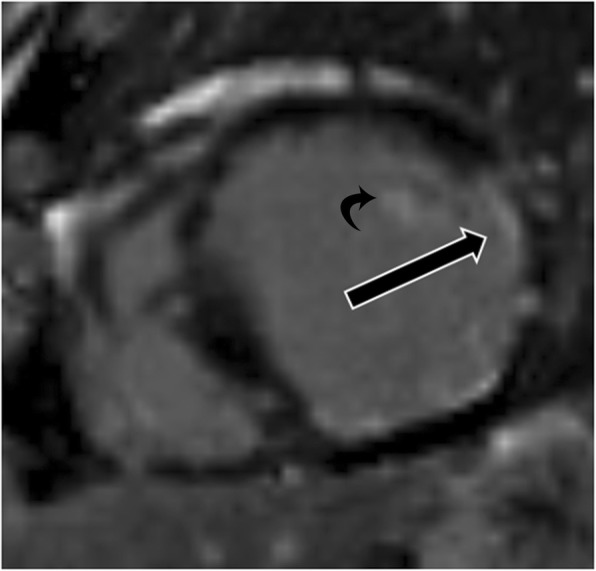 Fig. 15