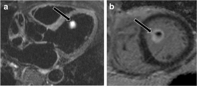 Fig. 20