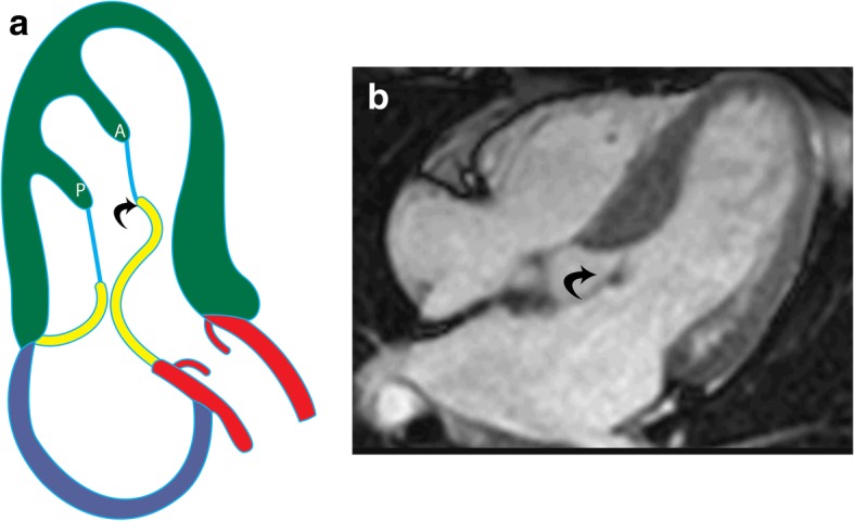 Fig. 14