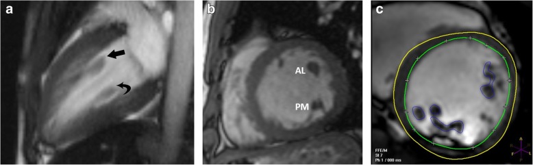 Fig. 2