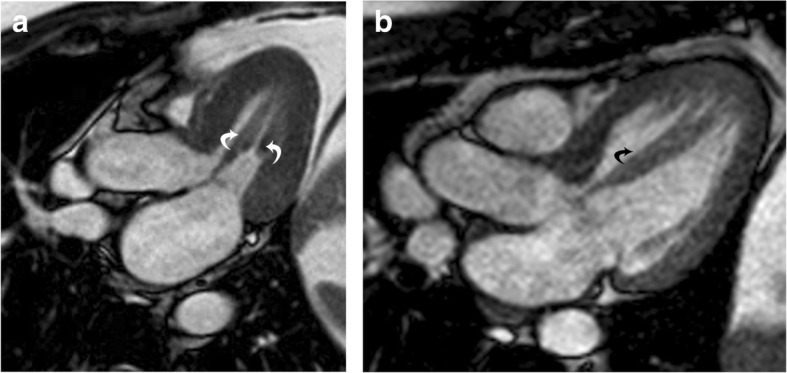 Fig. 9