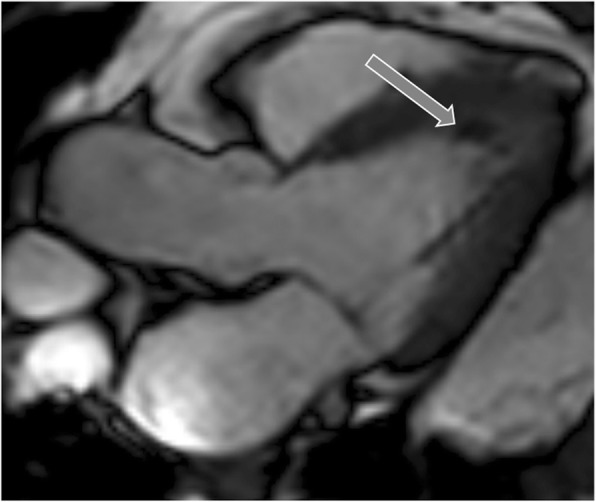 Fig. 16