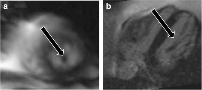 Fig. 18