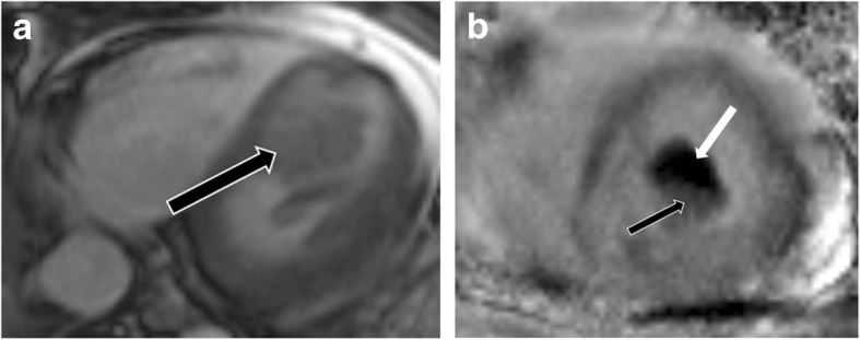 Fig. 22