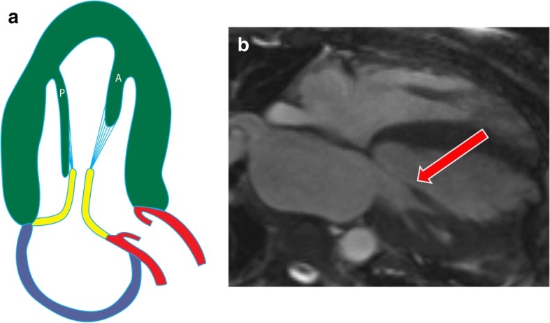 Fig. 5