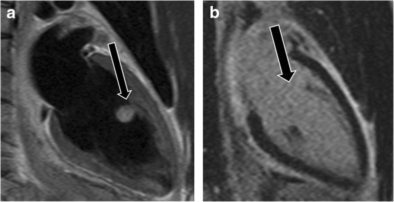 Fig. 19