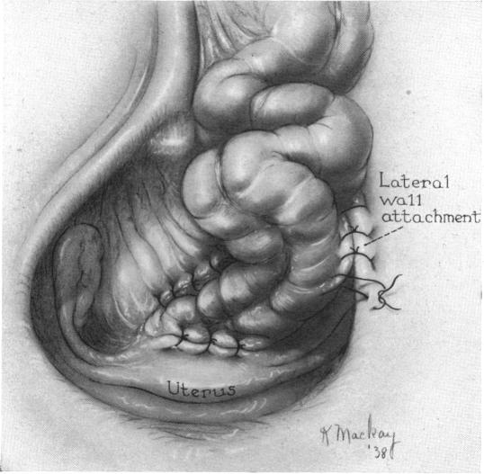 FIG. 5.