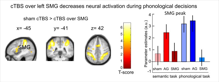 Figure 4—figure supplement 1.