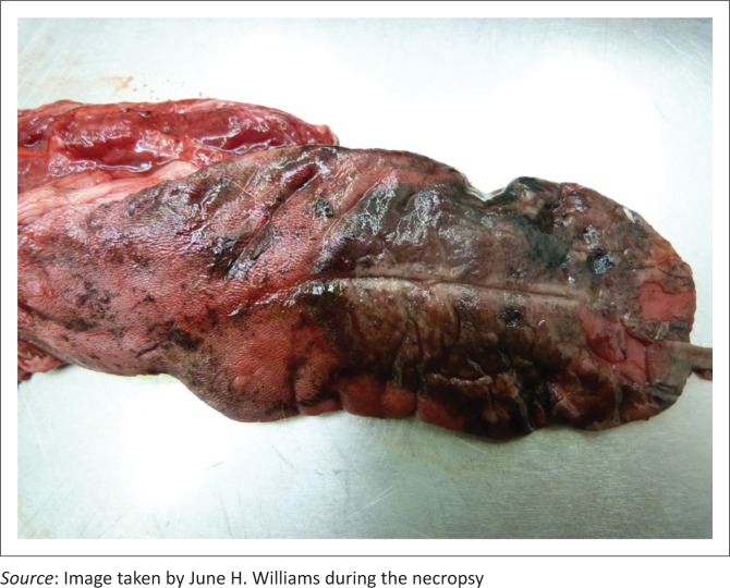 FIGURE 1