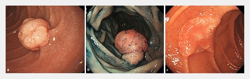 Fig. 1 a