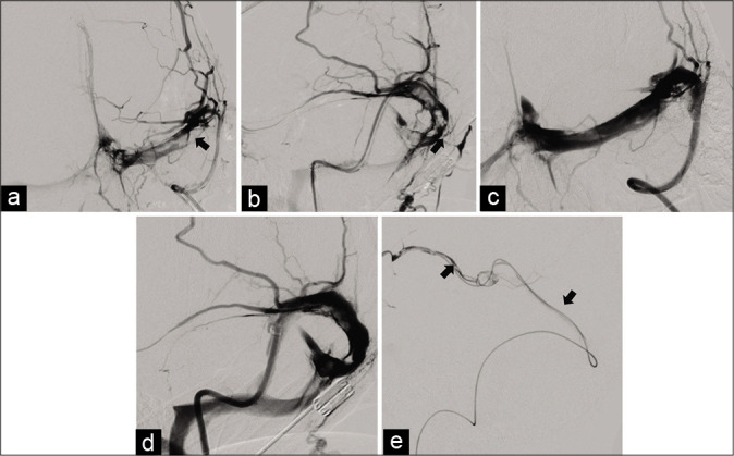 Figure 2: