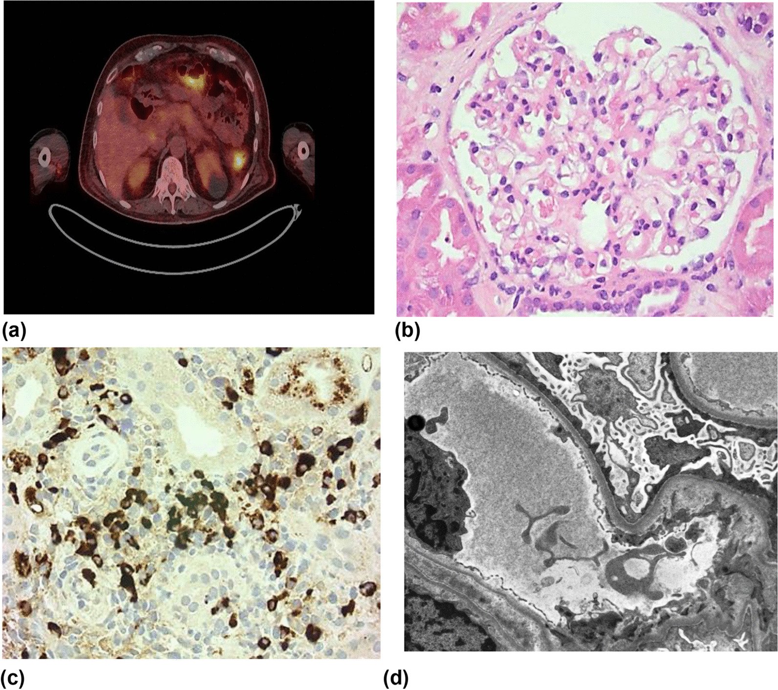 Fig. 1