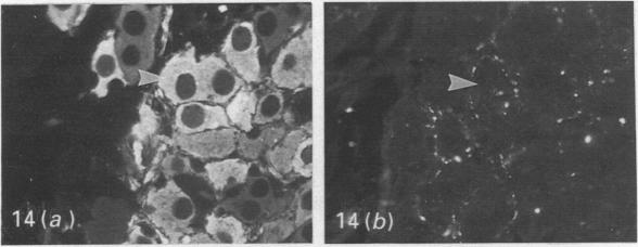 Fig. 14