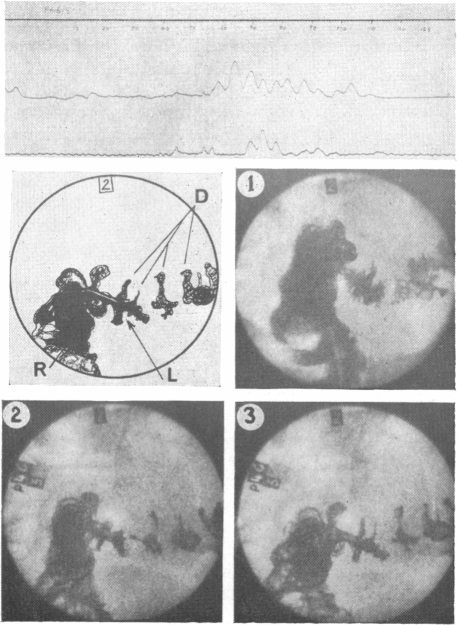 Fig. 12