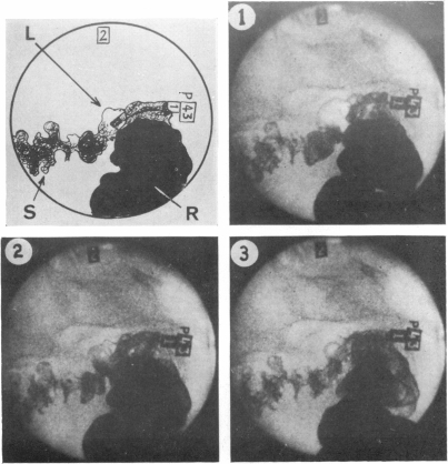 Fig. 11