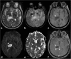 Fig. 14
