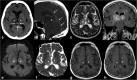Fig. 13