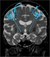Fig. 16
