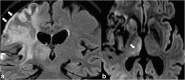 Fig. 15