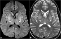 Fig. 12