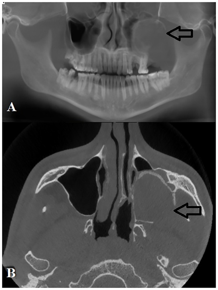 Fig 4