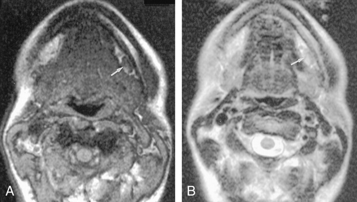 Fig 2.