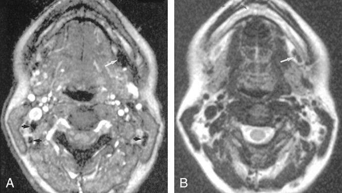 Fig 3.