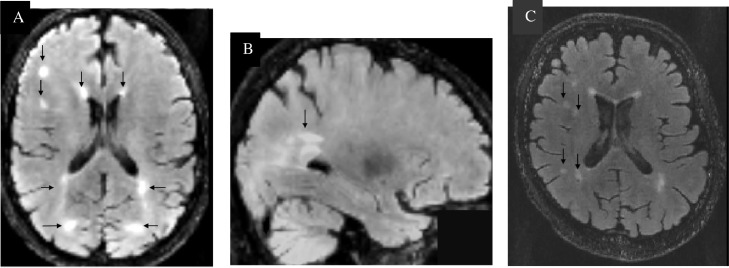 Fig 3